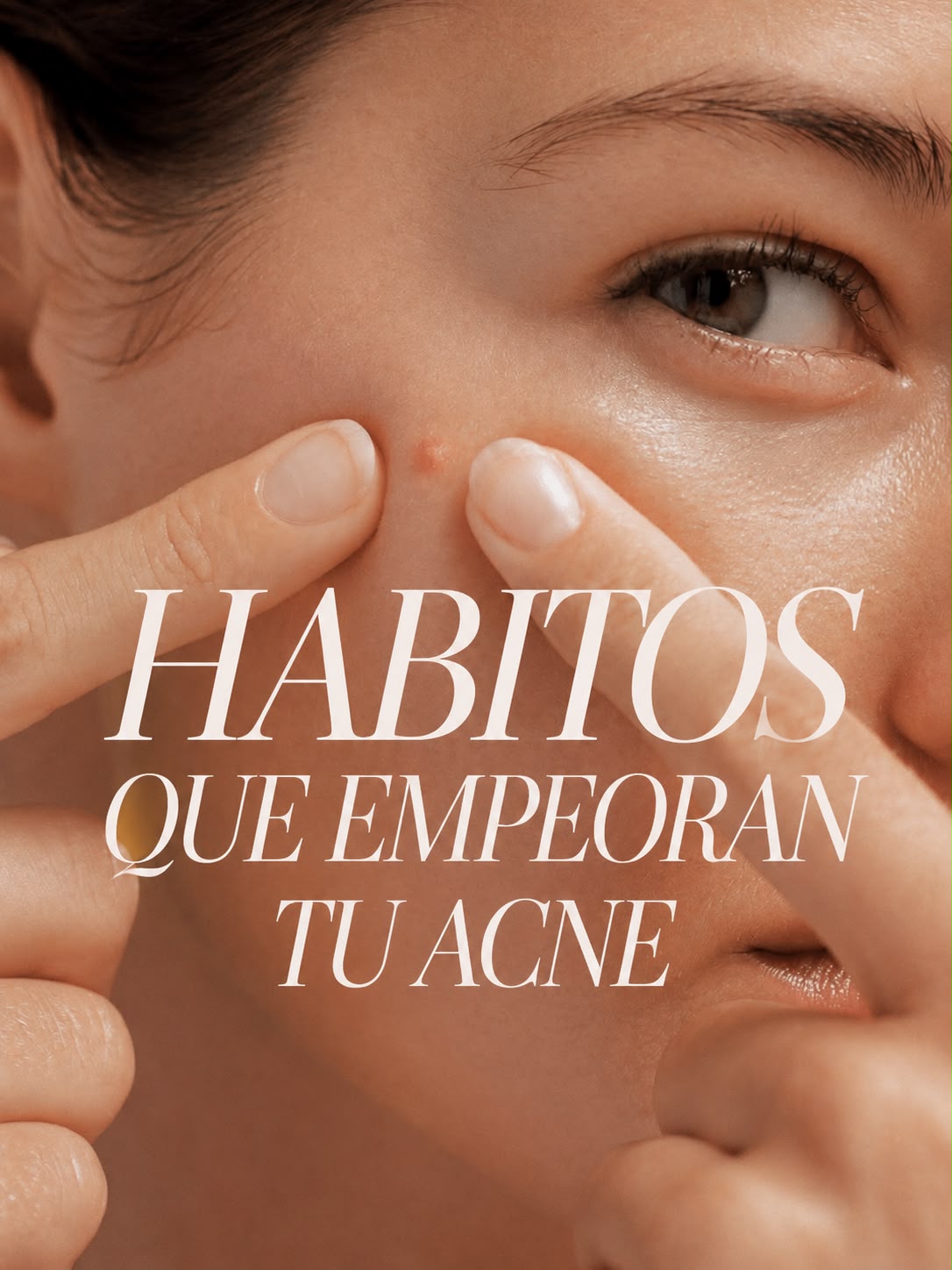 Hábitos que empeoran tu acne